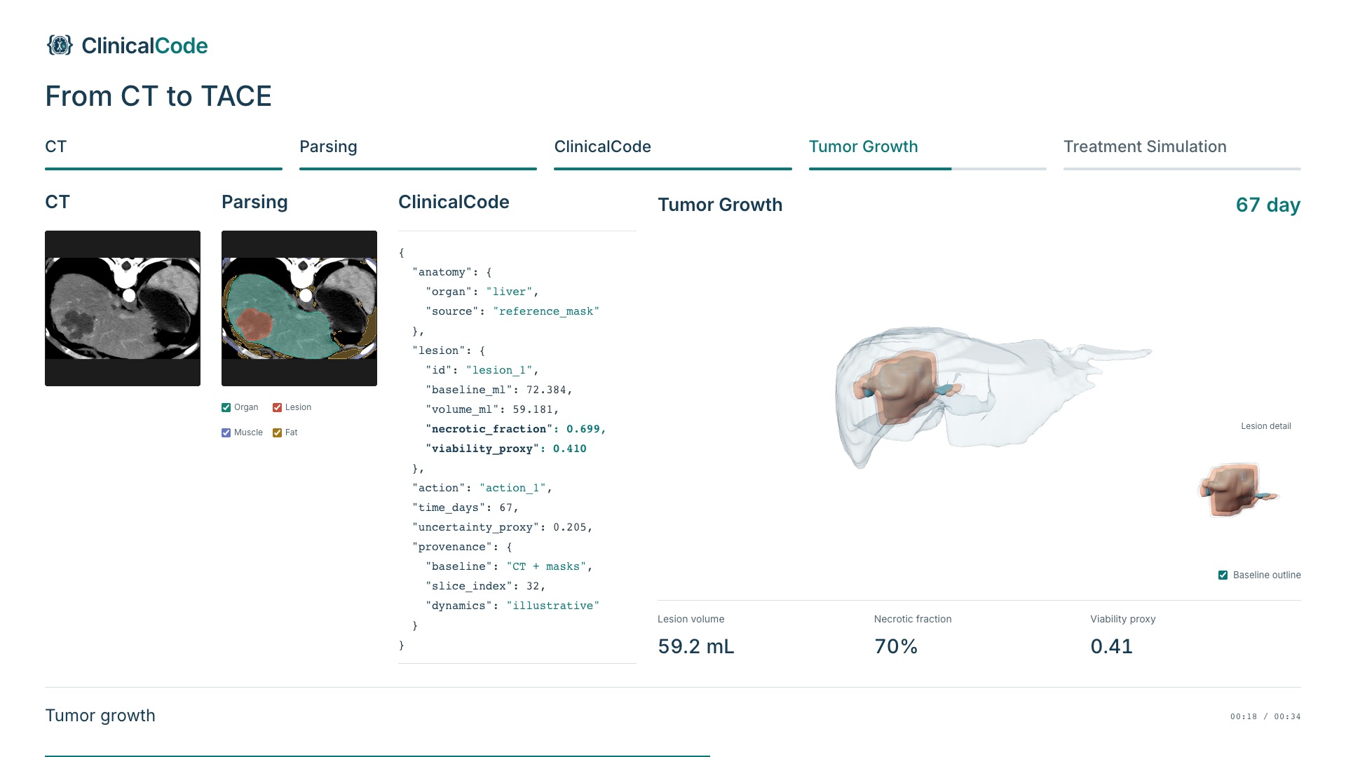 A step-by-step workflow: real CT, tissue parsing, structured ClinicalCode, tumor growth, and treatment simulation.