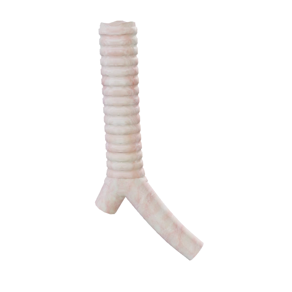 Trachea & bronchi: source anatomy and tissue appearance