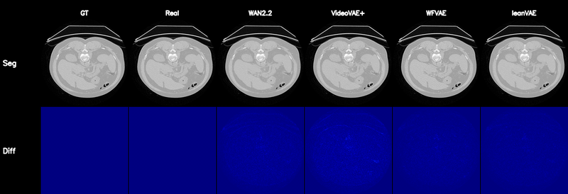 MSD Lung reconstruction and segmentation comparison