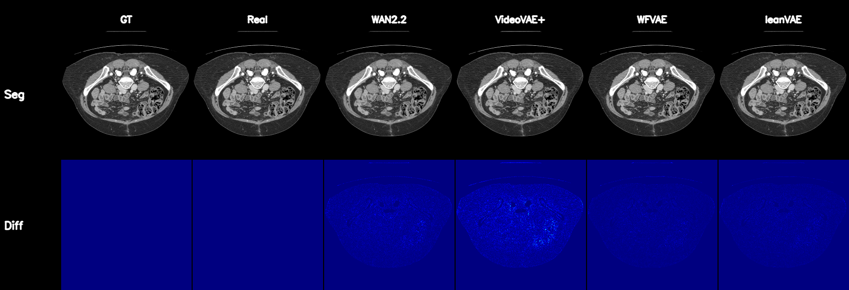 MSD Pancreas reconstruction and segmentation comparison