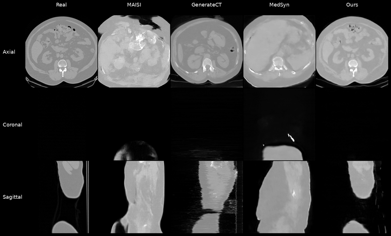 Three-view CT generation with anatomy and report conditioning